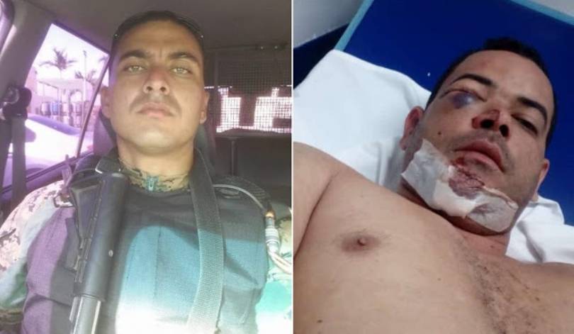 Policial que agrediu e atirou em servidor público é preso em São Luís