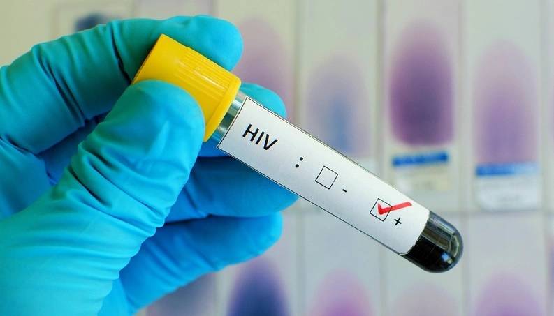 112 mil pessoas no Brasil não sabem que têm HIV; epidemia de AIDS é grave entre jovens