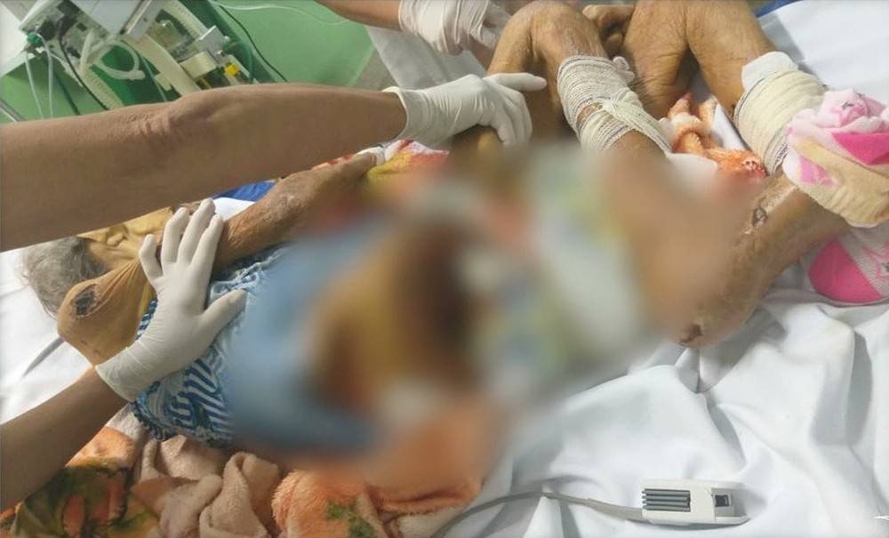 Idosa de 81 anos é encontrada doente e abandonada em Vargem Grande no MA