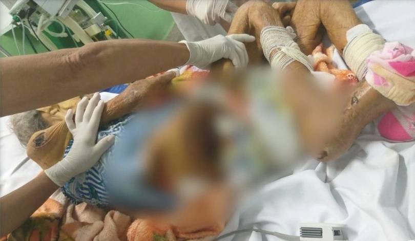 Filha de idosa vítima de maus-tratos tinha nojo da mãe, aponta investigação