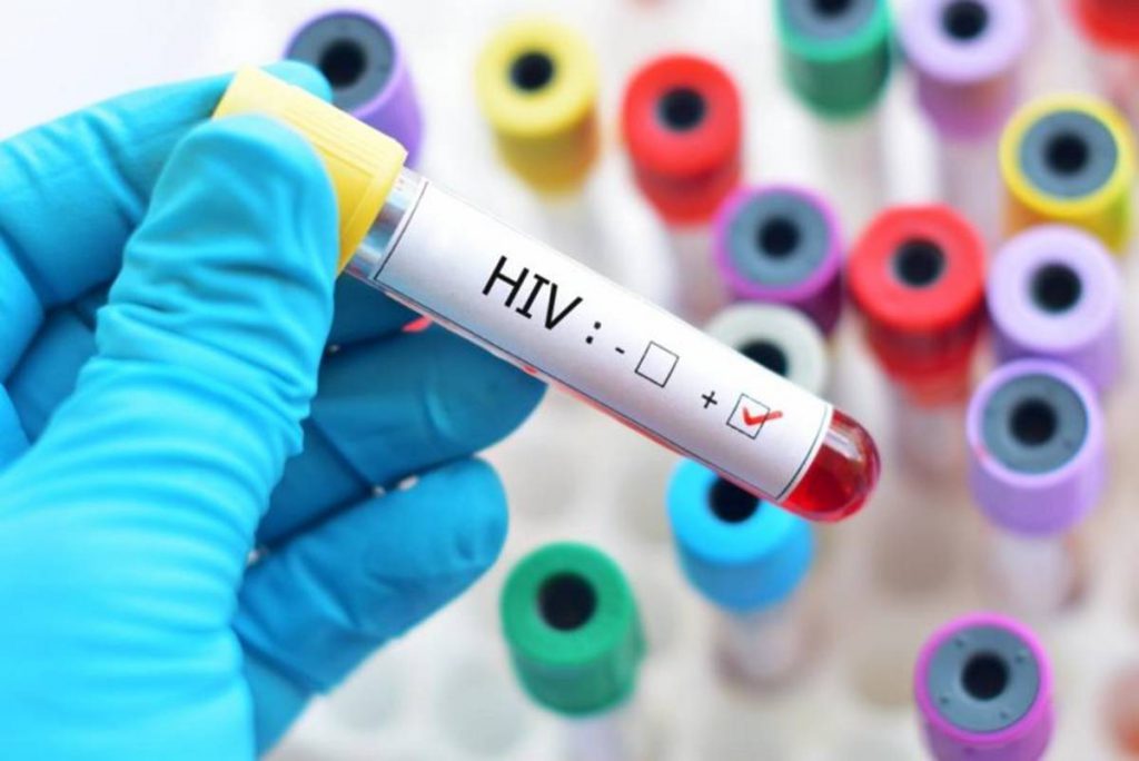 Maranhão é o 4º com maior taxa de detecção de casos de Aids no país