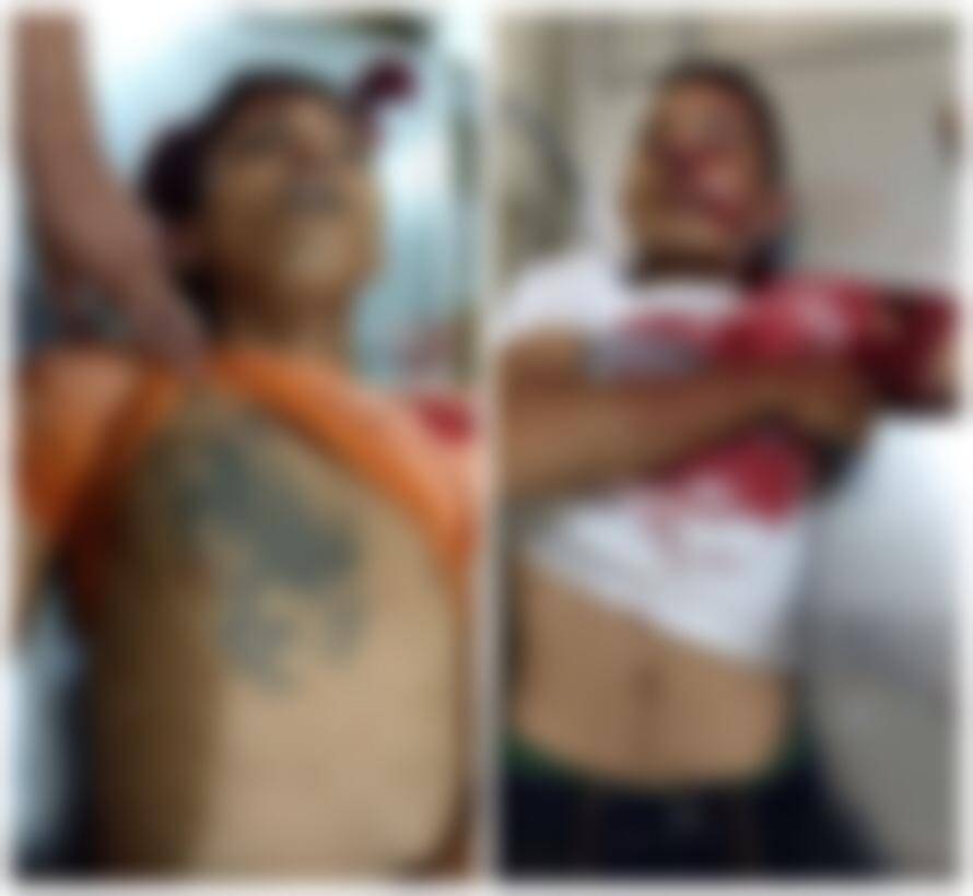 Dupla que assaltou e agrediu família morre em confronto com à polícia em Coroatá (MA)