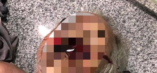 Idoso é assassinado com tiro no rosto em Codó no Maranhão