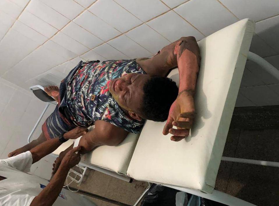 Gasolina armazenada de forma clandestina causa incêndio em Codó (MA)