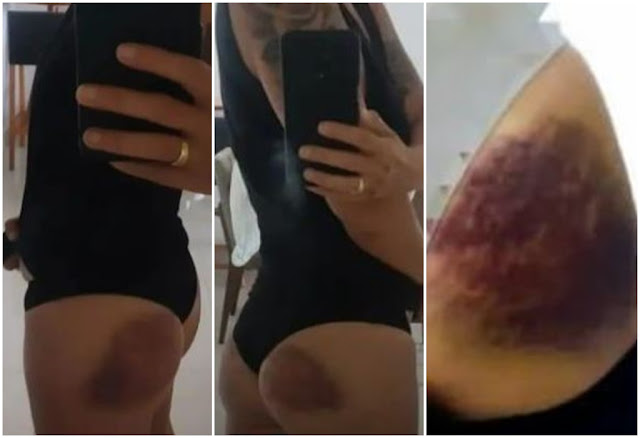 Investigadora do Maranhão é agredida a pauladas por instrutor durante curso tático no Ceará