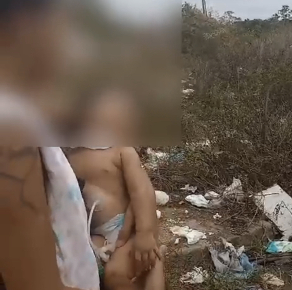 Criança que vive com ajuda de aparelho elétrico corre risco de vida após Equatorial retirar transformador no MA