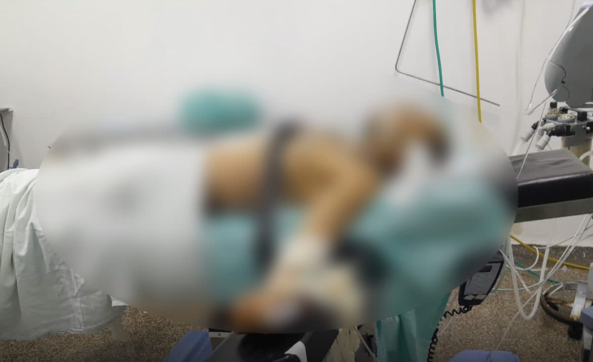 Homem mata a esposa na frente das filhas com facão, acaba sendo baleado pela PM e morre no hospital