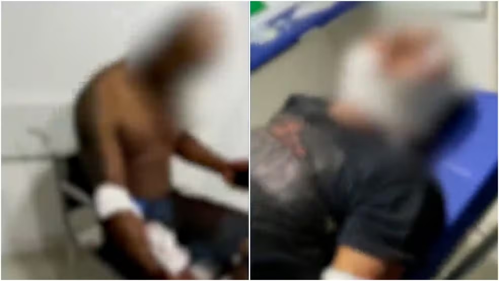 Ataque de pitbulls deixa três pessoas feridas em Paço do Lumiar no Maranhão