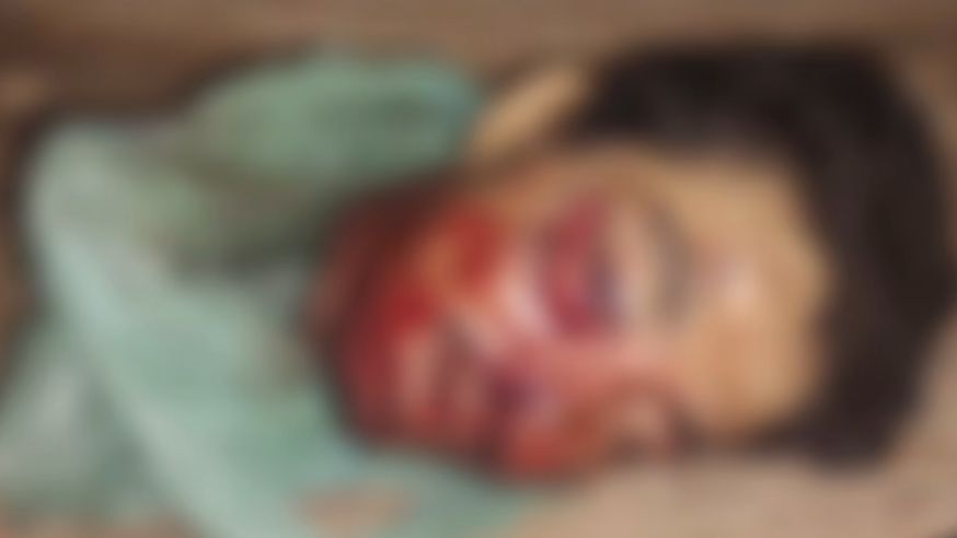 Criminosos arrancam a cabeça de homem e deixam na porta do conselho tutelar em Itinga do Maranhão