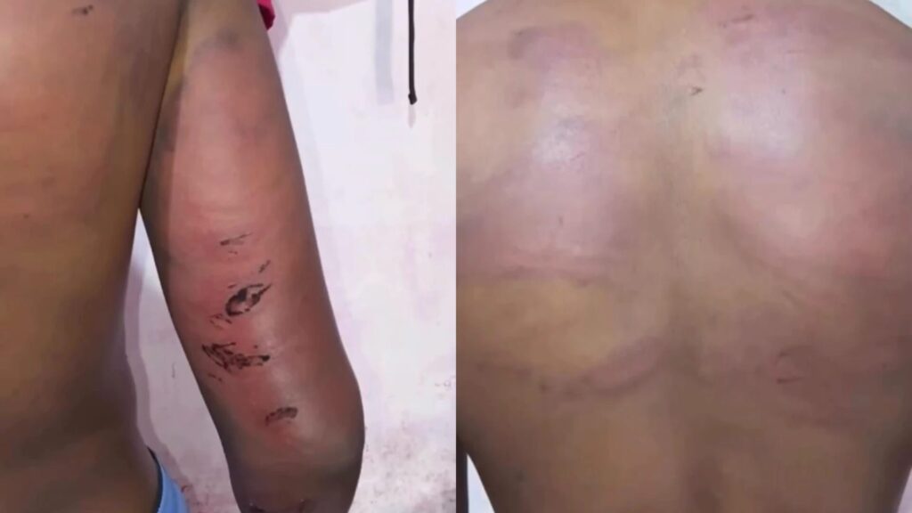 PM é afastado após denúncia de tortura contra adolescente em Trizidela do Vale