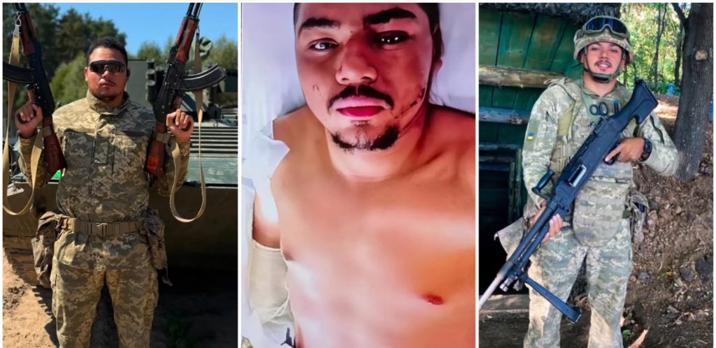 Maranhense de Estreito fica gravemente ferido na guerra entre Rússia e Ucrânia e perde parte do braço